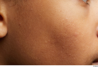 HD Face Skin Purcell Sutton cheek skin pores skin texture…